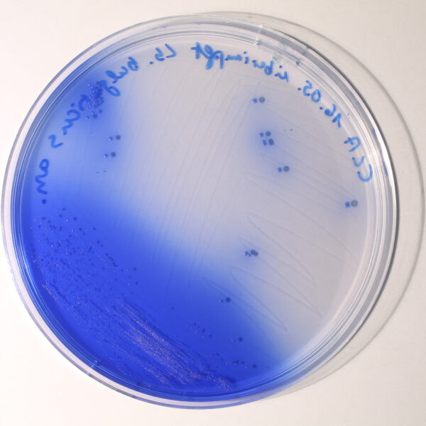 Lactobacillus_bulgaricus_colonies_05